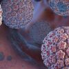 DEMESA | ¿Cuál es la mejor alternativa para tratar el VPH