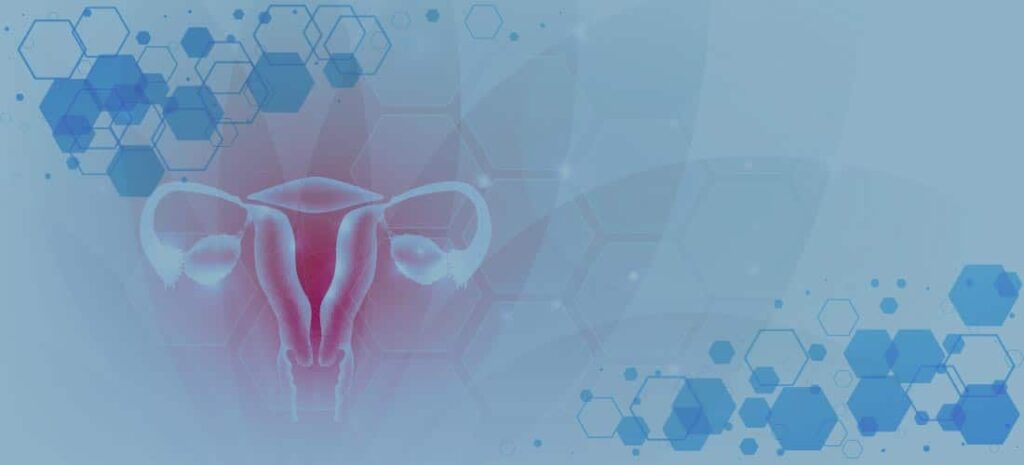 DEMESA | Endometriosis causas y consecuencias en la salud reproductiva